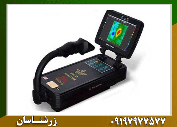 نقطه زن رویال بیسیک چیست؟